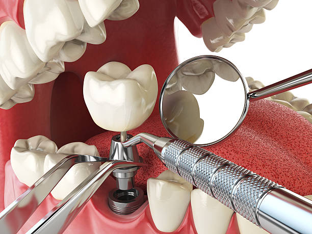 Best Emergency Root Canal Treatment in Chesilhurst, NJ